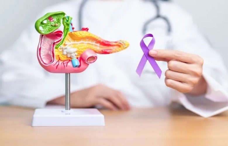 هل الحالات المرضية المصابة بسرطان المرارة قابلة للشفاء؟