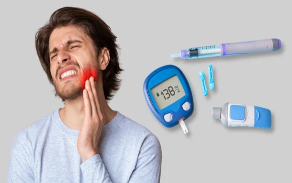 أمراض الأسنان الشائعة لدى مرضى السكري وكيفية العناية بهم