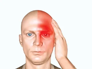 الصداع العنقودي