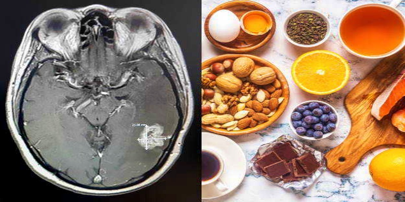 العناصر الغذائية الأساسية للمرضى الذين يعانون من قصور الغدة النخامية