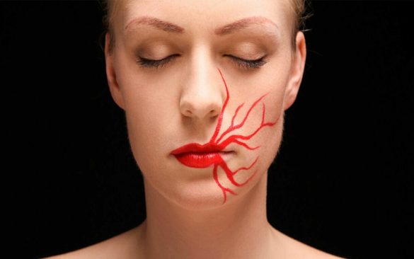 القوباء المنطقية العصبية الوجهية ومخاطر الإصابة بشلل الوجه النطاقي