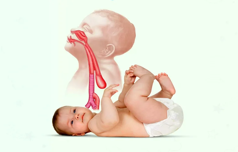 ضمور المريء عند الأطفال.. أهم الأسباب والأعراض وطرق العلاج