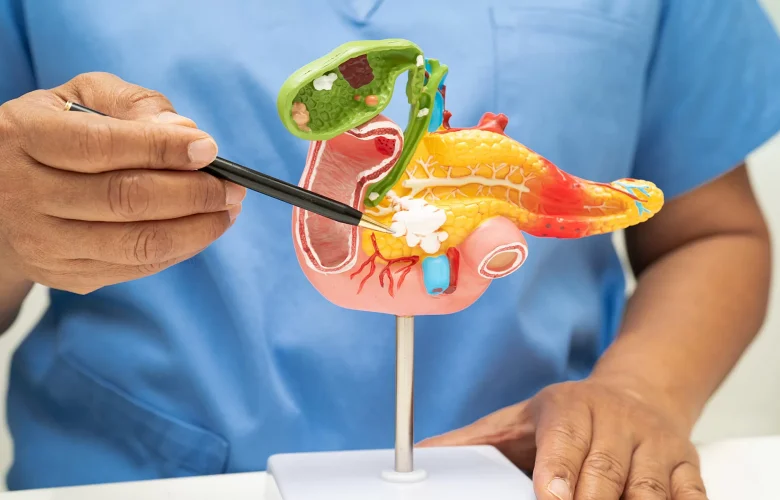 متى تحتاج سلائل المرارة إلى التدخل الطبي؟