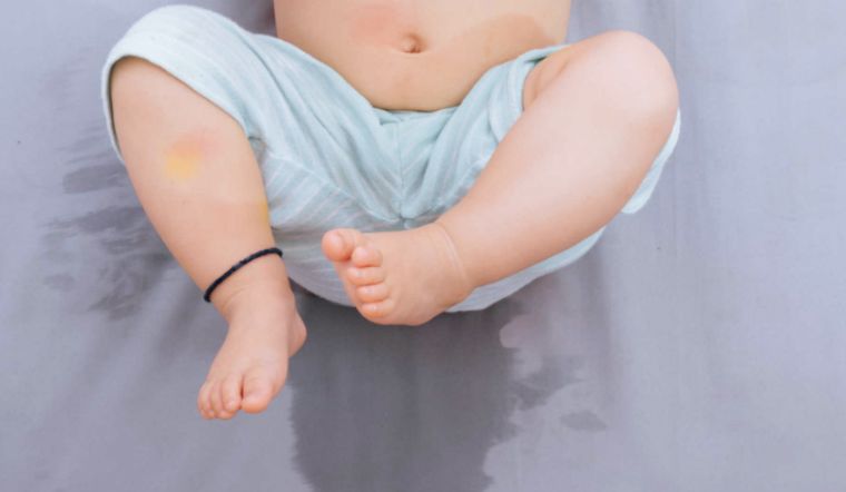 مرض السكري الكاذب لدى الرضع مرض السكري الكاذب لدى الرضع