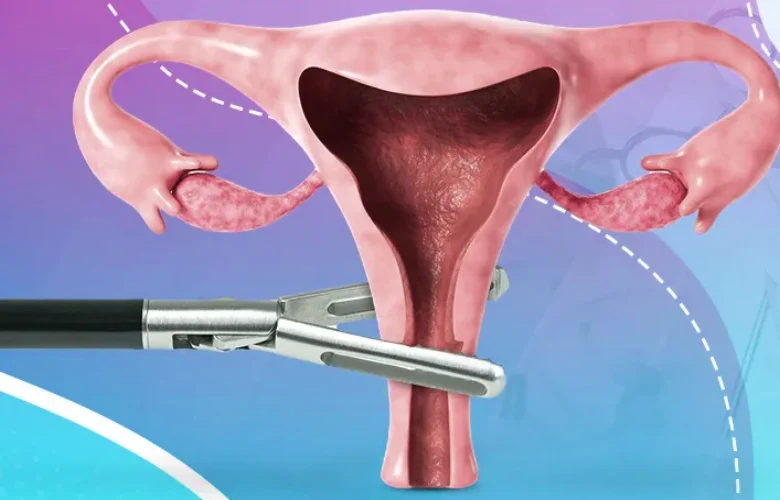 6 أمراض قد تتطلب اللجوء إلى استئصال الرحم