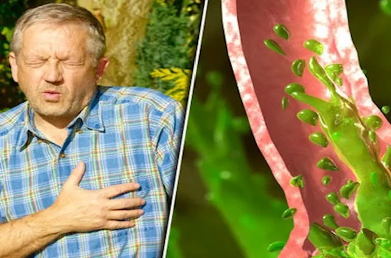 ارتجاع الكبد ارتجاع الكبد