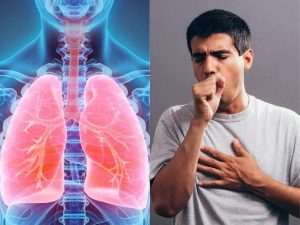 الأعراض الشائعة لسرطان الرئة الغدى 