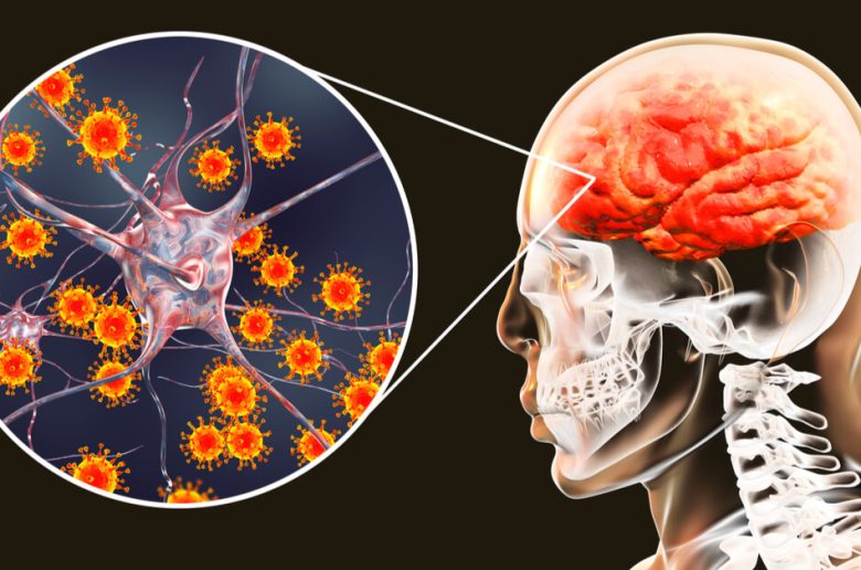 كيف نميز بين التهاب السحايا البكتيري والفيروسي ؟