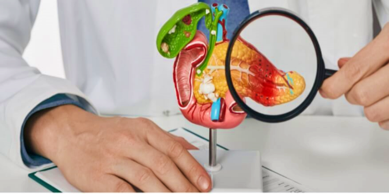 ما هي طرق علاج التهاب البنكرياس الحاد؟