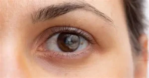 متى تصبح البقع العادية علامة تحذيرية ؟