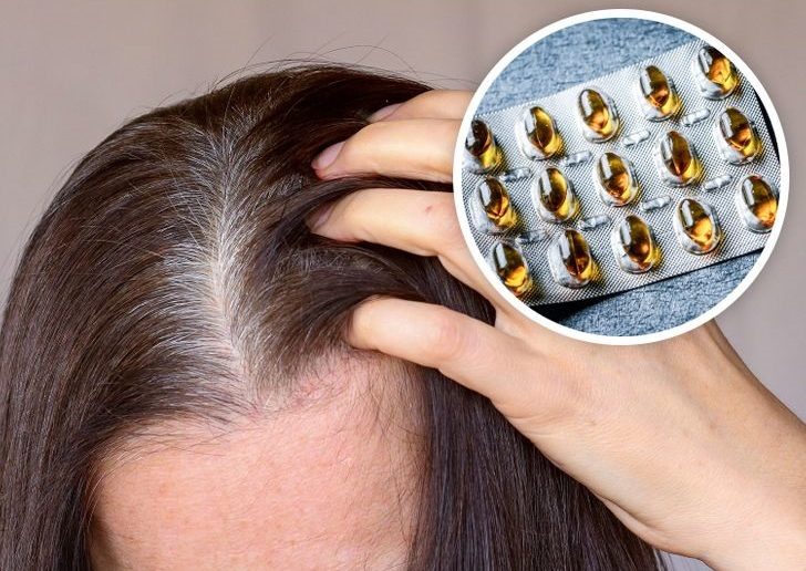 نقص الفيتامينات المؤدي إلى ظهور الشيب المبكر للشعر