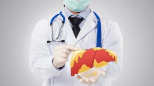 هل يمكن أن يتحول مرض الكبد الدهني إلى قاتل خفي ؟