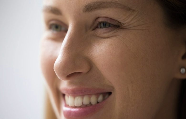 5 طرق طبيعية للتغلب على تجاعيد الابتسامة في المنزل