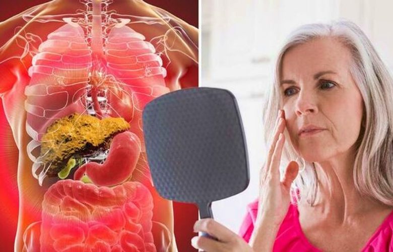 6 علامات مرضية تظهر على الجلد تدل على حاجة الكبد إلى الرعاية الفورية