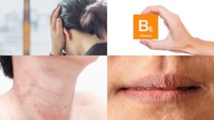 أعراض أخرى لا يمكن توقعها