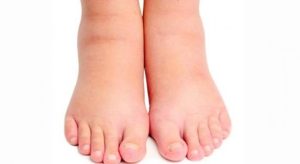 أعراض زلال الحمل