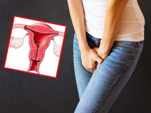 الأعراض الشائعة للتشنج المهبلي