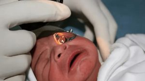 الخضوع لإختبارات الفحص المبكرة