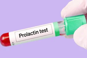 حول أسباب ارتفاع هرمون الحليب