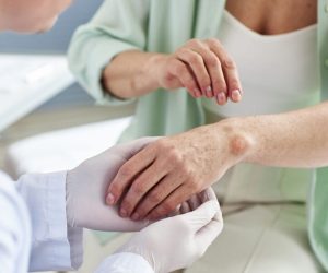 طرق التكيف مع الآثار الجلدية الناجمة عن العلاج الكيماوي