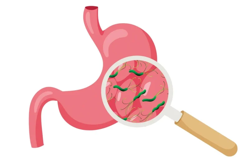 عودة جرثومة المعدة بعد العلاج