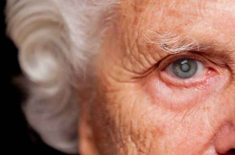 فواكه للوقاية من مشكلة المياء البيضاء