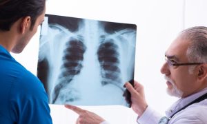 أسباب وجود ماء على الرئة