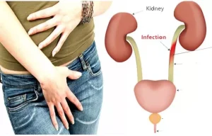 أقراص ماكروفيوران العلاجية لإلتهاب المسالك البولية