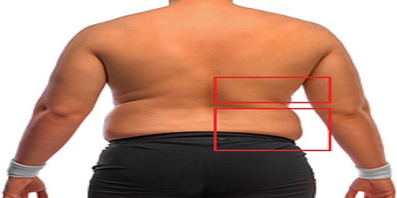 أهمية التخلص من دهون الظهر