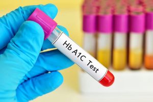 اختبار الهيموجلوبين السكري(HbA1c)