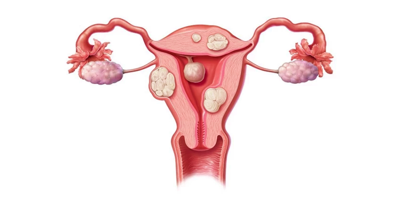 عوامل الخطر القابلة للتحكم