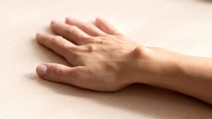 الأكياس الدهنية في معصم اليد