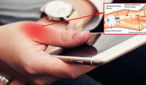 التعرض للإجهاد المتكرر