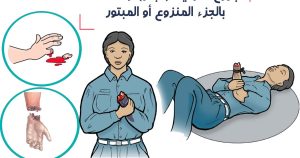 الجروح النزعية