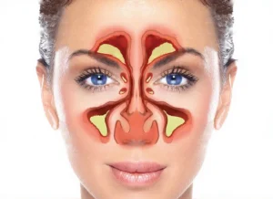 الجيوب الأنفية