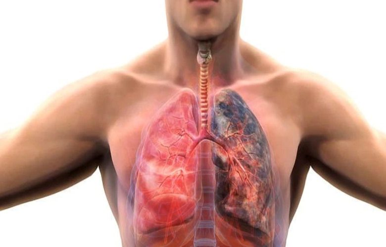 الخيارات العلاجية لمرض الانسداد الرئوي المزمن