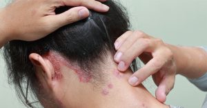 النمو المفرط للبكتيريا والفطريات