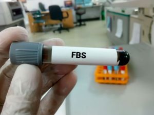 تحليل السكر الصائم