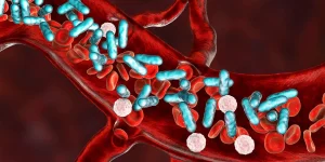 جرثومة الدم والصدمة الإنتانية