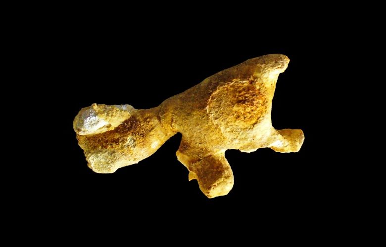 حصوات الكلى المرجانية.. ما هي؟ وما خطورتها على الحالة الصحية؟