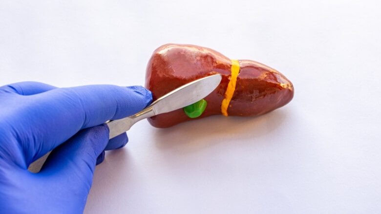 علامات تحذيرية تخبرك عن ضرورة استئصال المرارة