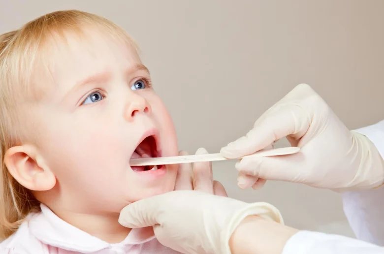 كيفية وقاية طفلك من خراج اللوزتين