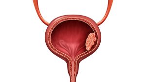 ما هى دواعي استعمال أقراص ماكروفيوران؟