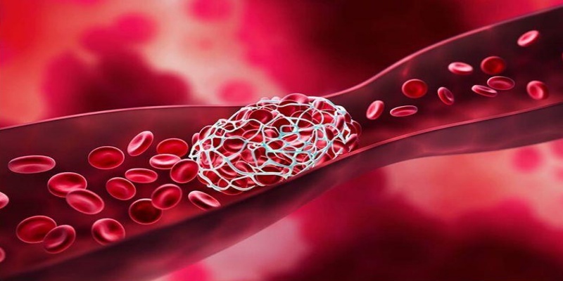 ما هي آلية عمل مميعات الدم؟