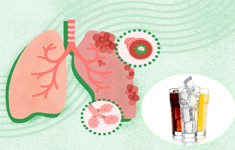 مشروبات يجب الإبتعاد عنها للحفاظ على صحة الرئتين