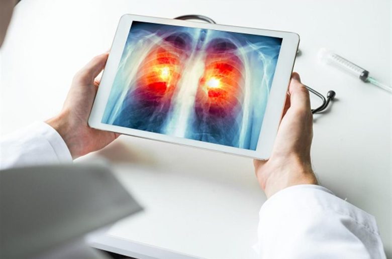 مضاعفات الإلتهاب الرئوي