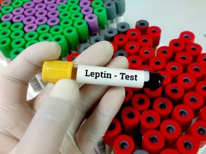 نقص هرمون الشبع 