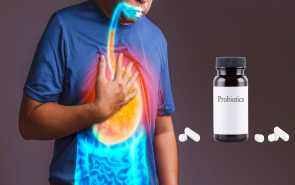 هل يجب استخدام البروبيوتيك لتقليل ارتجاع حمض المعدة؟