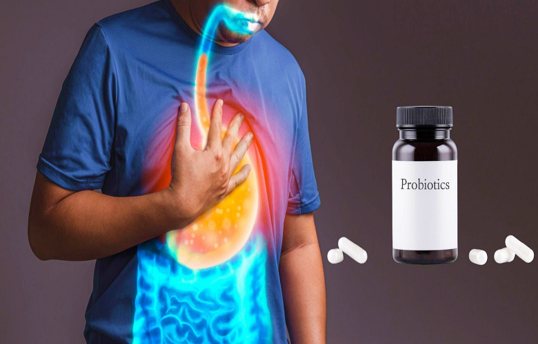 هل يجب استخدام البروبيوتيك لتقليل ارتجاع حمض المعدة؟