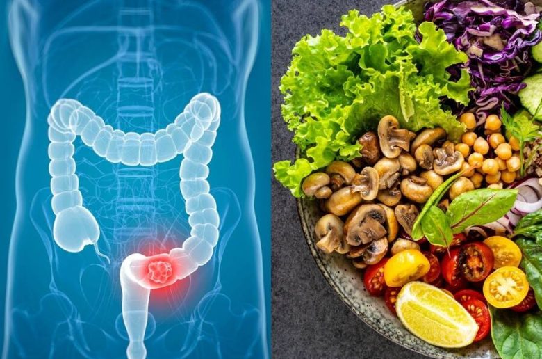 وجبات يومية خفيفة لوقاية القولون من مخاطر السرطان